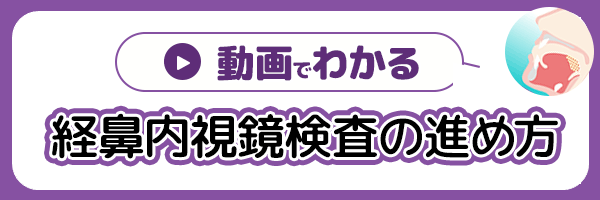 動画でわかる経鼻内視鏡検査の進め方
